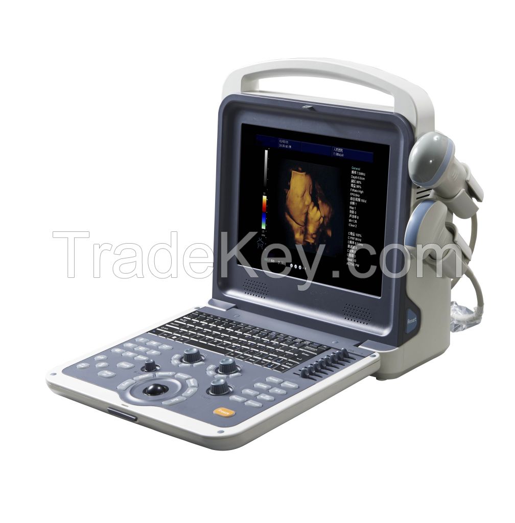 MP-U06 Portable color ultrasound scanner