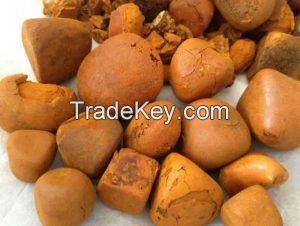 OX  Gallstones