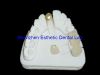 Sell dental Captek crown