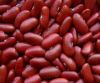 Dark Red, Black, Red Kidney Beans Available