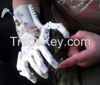 3D Printed Medical equipment