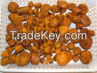OX Gallstones