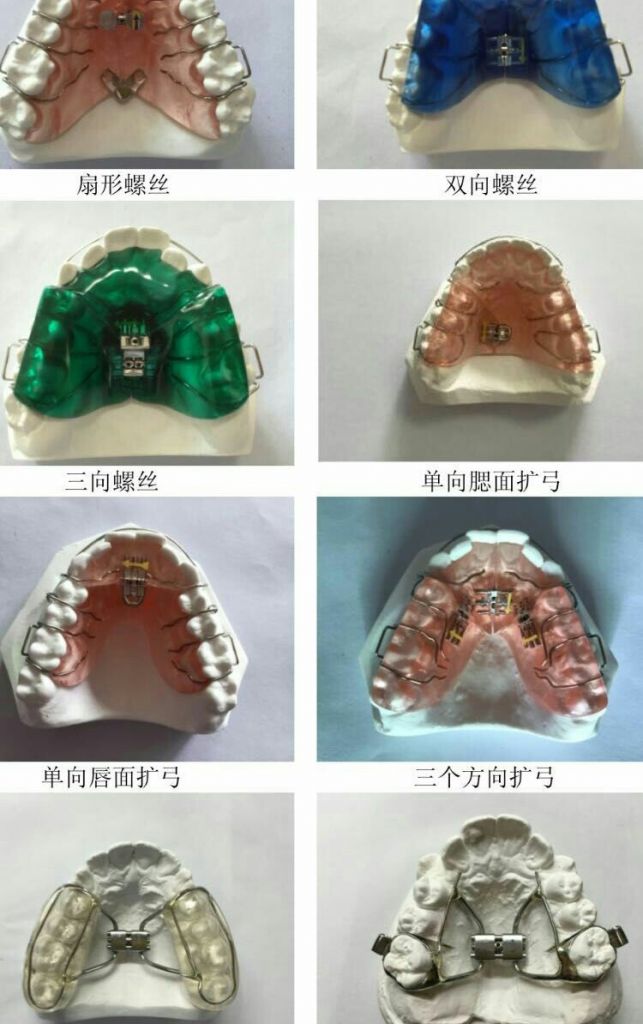 orthodonticappliance, dental supplies