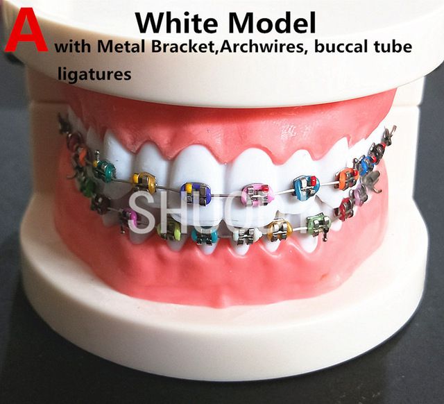 Dental Tooth Model Orthodontic Model for Patient Communication Dental Study