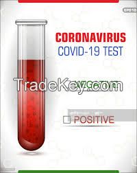 Coronavirus Test SARS-CoV2 IgG/IgM