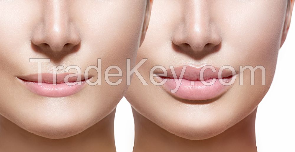 Dermal Filler, Dermal Fillers