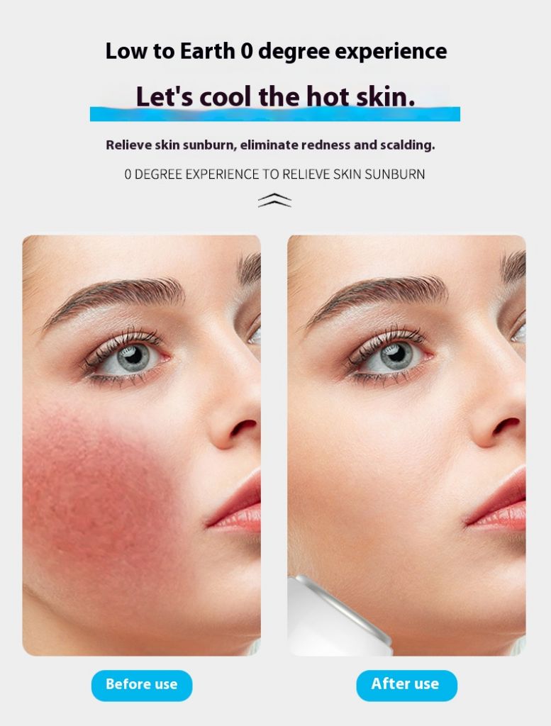 Rf Home Use Device 3 In 1 Rf Radio Frequency Facial Machine portable Rf Beauty Device