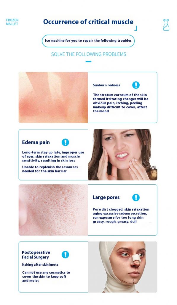 Rf Home Use Device 3 In 1 Rf Radio Frequency Facial Machine portable Rf Beauty Device