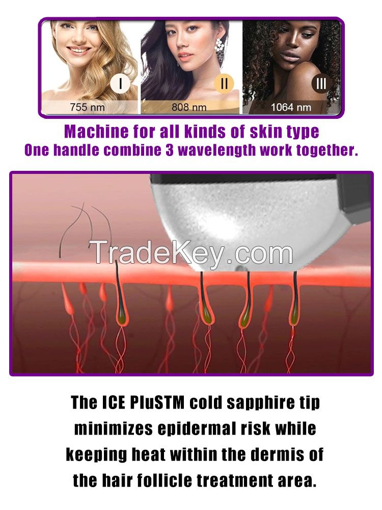 808nm diode laser hair removal machine 