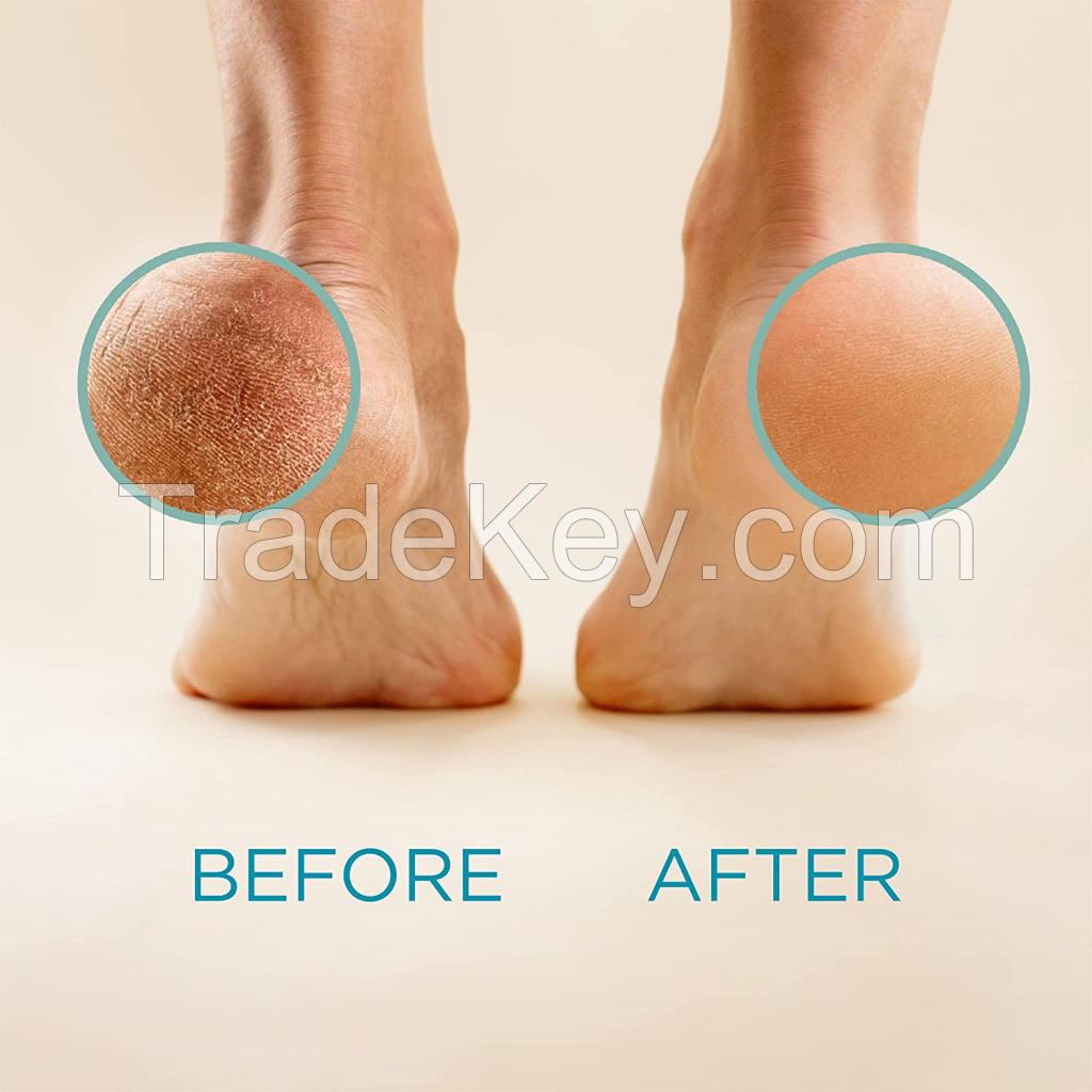 Lemon Gallon Pedicure Callus Remover Gel