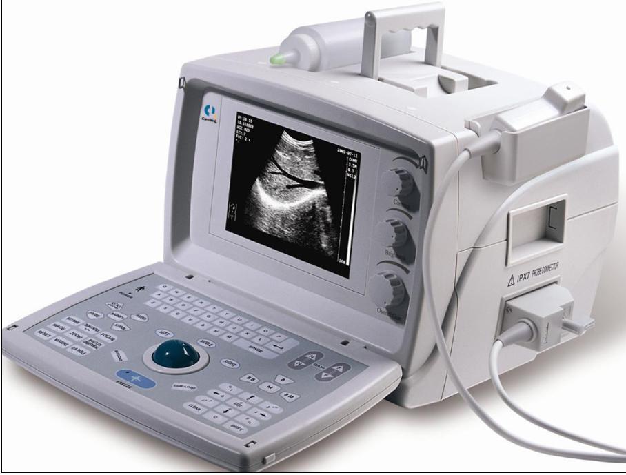 ULTRASOUND SCANNER