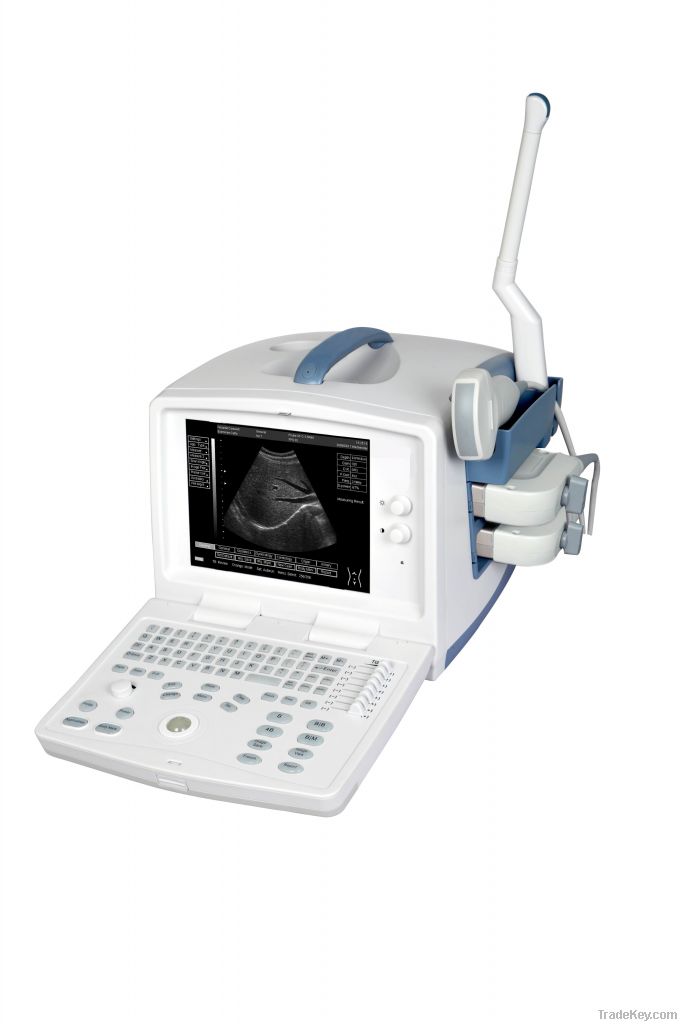 Digital Ultrasonic Diagnostic Imaging System