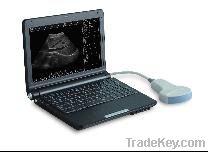 Portable B mode ultrasound scanner