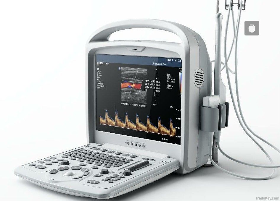 Portable Color Doppler Ultrasound Scanner