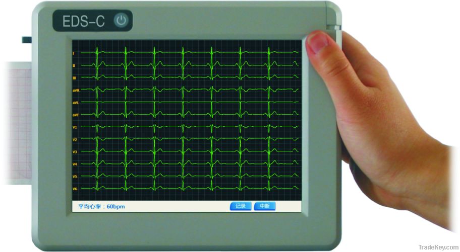 Electrocardiograph System (ECG)