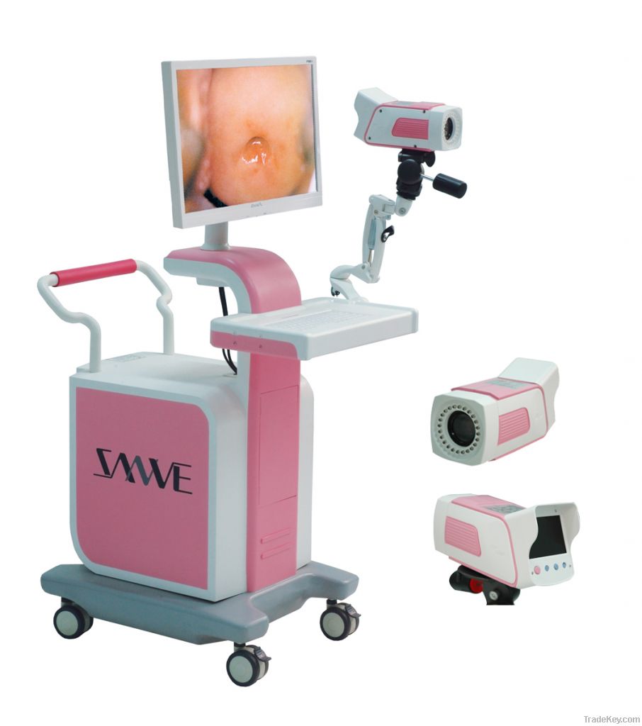 digital colposcope