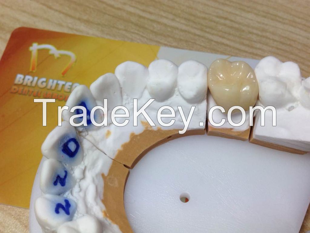 Dental Restoration  Sagemax Zirconia