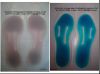 Liquid-gel-filled Inne...