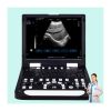 N60 Portable Ultrasoun...