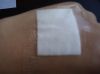 wound plaster