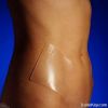 Sterile Hydrogel Dress...