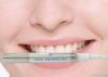 Teeth whitening pen wi...