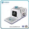 Portabe B/W Ultrasound...