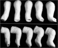 Miniature plaster casts used for a nonsurgical treatment for infants born 