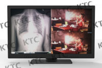 KTC medical monitor Integrated display