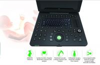 Laptop  Ultrasound Color Doppler scanner diagnostic machine 3D/ 4D model C300