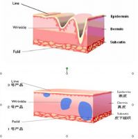 Hyaluronic Acid Cosmetic Anti Wrinkles Dermal Filler