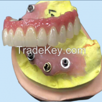 Dental Implant Bar For Crowns And