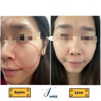 ãReady Stockã Whitening/Moisturizing/Anti-inflammatory/Anti-Aging Regeneration Bright Cream