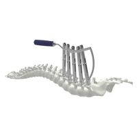 Monoaxial Reduction Pedicle Screw Type-IV