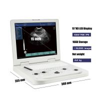 Portable 3d 4d Echo Ultrasound Machine