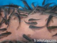 Skin Callus Remover--Doctor Fish Spa