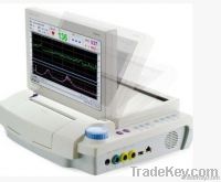 Three parameters of fetal monitor