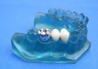 removeable denture