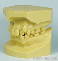 Resin Malocclusion Jaw Model/Resin Malocclusion