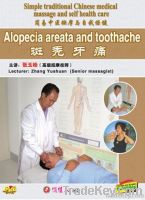 Training DVD Alopecia Areata And Toothache Massage