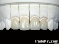 Dental Restoration All Ceramic Crown