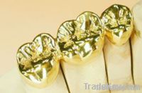 Dental Restoration Gold Crown