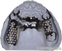 Metal Framework Vitallium Framework Dental Removable Restoration