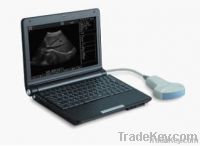 B Mode Ultrasound Scanner