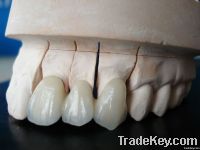 Cheap Dental Crown/Bridge