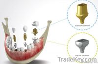 Natural and Scallop Abutment