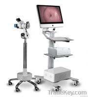 Digital Optical Colposcope