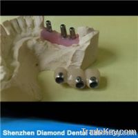 Dental Implant Crowns