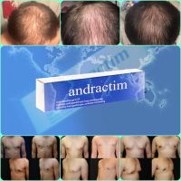 Treat Hair Loss